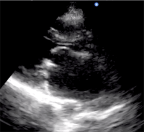An example ultrasound moving image